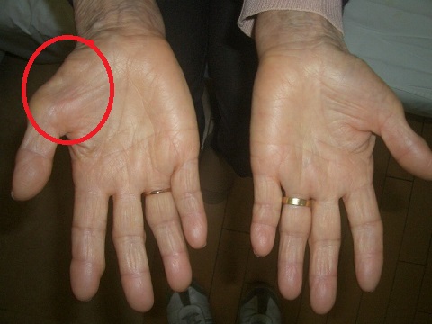 肺がんの治療目標は何ですか?